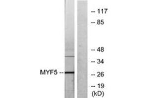 Western blot analysis of extracts from HepG2 cells, using MYF5 Antibody. (MYF5 Antikörper  (AA 61-110))