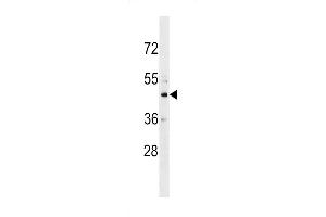 Western blot analysis in HL-60 cell line lysates (35ug/lane). (CHST10 Antikörper  (C-Term))