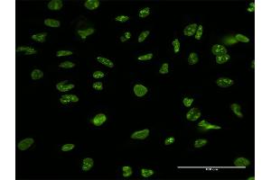 Immunofluorescence of purified MaxPab antibody to NCL on HeLa cell. (Nucleolin Antikörper  (AA 1-710))