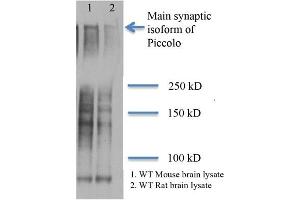 Piccolo Western Blot. (PCLO Antikörper)