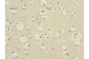 Immunohistochemistry of paraffin-embedded human brain tissue using ABIN7147410 at dilution of 1:100 (CEP57 Antikörper  (AA 1-240))