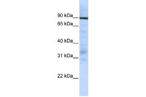 WB Suggested Anti-EWSR1 Antibody Titration:  0. (EWSR1 Antikörper  (Middle Region))
