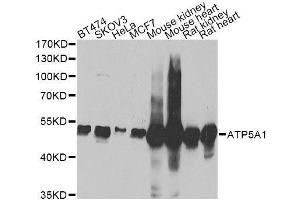 Western blot analysis of extracts of various cell lines, using ATP5A1 Antibody. (ATP5A1 Antikörper)