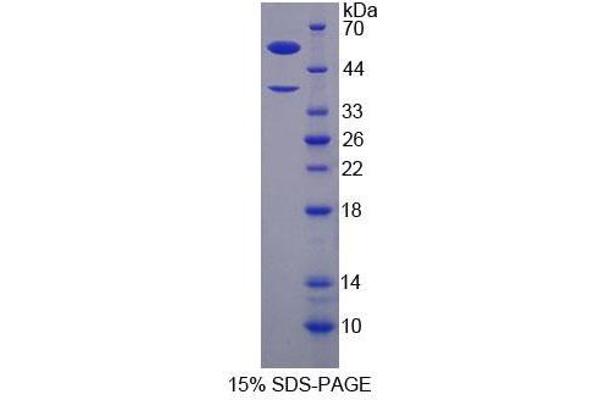 H2AFY Protein