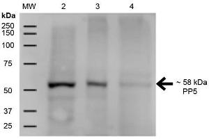 Western Blot analysis of Human A431, HEK293, and Jurkat cell lysates showing detection of ~58 kDa PP5 protein using Mouse Anti-PP5 Monoclonal Antibody, Clone 12F7 . (PP5 Antikörper  (Atto 488))