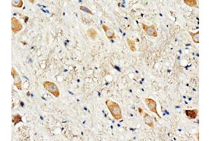 Anti-Dopamine Receptor D3 antibody, IHC(P) IHC(P): Rat Brain Tissue (DRD3 Antikörper  (C-Term))