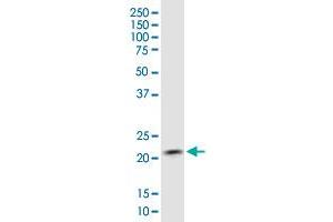 Western Blotting (WB) image for anti-Copper Metabolism (Murr1) Domain Containing 1 (COMMD1) (AA 1-190) antibody (ABIN566862)