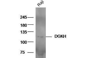 Raji cell lysates probed with Anti-DGKH Polyclonal Antibody  at 1:5000 90min in 37˚C. (DGKH Antikörper  (AA 51-150))