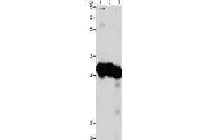 Western Blotting (WB) image for anti-Ketohexokinase (KHK) antibody (ABIN2429498) (Ketohexokinase Antikörper)