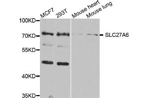 Western blot analysis of extracts of various cell lines, using SLC27A6 antibody (ABIN5974523) at 1/1000 dilution. (SLC27A6 Antikörper)