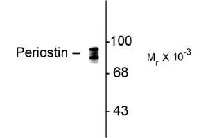 Image no. 1 for anti-Periostin (POSTN) antibody (ABIN372701) (Periostin Antikörper)