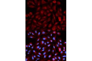 Immunofluorescence analysis of HeLa cell using PSME3 antibody. (PSME3 Antikörper  (AA 1-254))