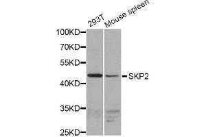 Western blot analysis of extracts of various cell lines, using SKP2 antibody (ABIN5995995) at 1/1000 dilution. (SKP2 Antikörper)