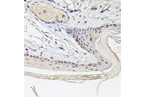 Immunohistochemistry (IHC) image for anti-Ets Variant 4 (ETV4) (AA 1-207) antibody (ABIN6140332)