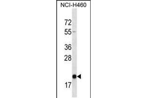 Western blot analysis in NCI-H460 cell line lysates (35ug/lane). (TMED2 Antikörper  (N-Term))