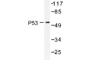 Image no. 1 for anti-Tumor Protein P53 (TP53) antibody (ABIN272050) (p53 Antikörper)