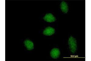 Immunofluorescence of purified MaxPab antibody to DNAJB6 on HeLa cell. (DNAJB6 Antikörper  (AA 1-326))