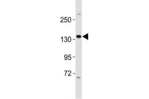 Western blot testing of ERBB4 antibody at 1:2000 dilution + MCF-7 lysate; Predicted molecular weight: 147-180 kDa (precursor), 120, 80 kDa (cleaved forms). (ERBB4 Antikörper  (AA 1141-1166))