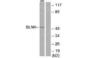 Immunohistochemistry analysis of paraffin-embedded human tonsil tissue using BLNK (Ab-96) antibody. (B-Cell Linker Antikörper)