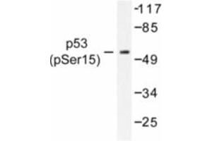 Image no. 1 for anti-Tumor Protein P53 (TP53) (pSer15) antibody (ABIN318091) (p53 Antikörper  (pSer15))