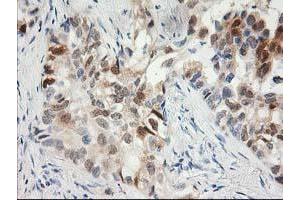 Immunohistochemistry (IHC) image for anti-Hydroxyprostaglandin Dehydrogenase 15-(NAD) (HPGD) antibody (ABIN1496363) (HPGD Antikörper)