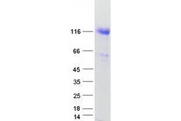 UBA1 Protein (Transcript Variant 1) (Myc-DYKDDDDK Tag)