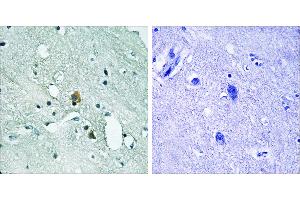P-peptide - +Immunohistochemistry analysis of paraffin-embedded human brain tissue using IP3R1 (Phospho-Ser1764) antibody. (ITPR1 Antikörper  (pSer1764))