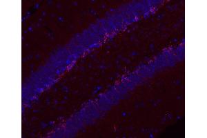 Indirect immunostaining of paraffin embedded PFA fixed mouse hippocampus section (1 : 200; red). (Doublecortin Antikörper)