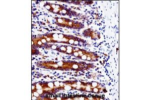 Immunohistochemistry (Paraffin-embedded Sections) (IHC (p)) image for anti-Proto-oncogene tyrosine-protein kinase Src (Src) (AA 24-52), (N-Term) antibody (ABIN1881833)