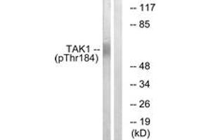 Western blot analysis of extracts from HepG2 cells treated with TNF 20ng/ml 5', using TAK1 (Phospho-Thr184) Antibody. (TR4 Antikörper  (pThr184))
