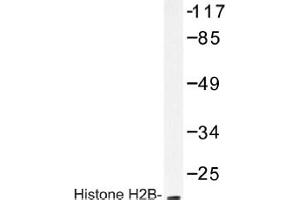 Image no. 1 for anti-Histone H2B antibody (ABIN317616) (Histone H2B Antikörper)