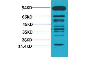 Western Blotting (WB) image for anti-Methylated Lysine (pan) antibody (ABIN3181570) (Methylated Lysine (pan) Antikörper)