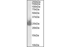 Image no. 1 for anti-Synaptosomal-Associated Protein, 25kDa (SNAP25) (C-Term) antibody (ABIN372760) (SNAP25 Antikörper  (C-Term))