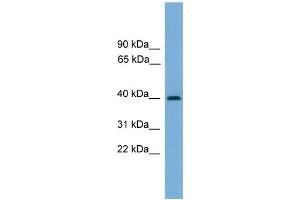 WB Suggested Anti-SERPINB8 Antibody Titration: 0. (SERPINB8 Antikörper  (Middle Region))