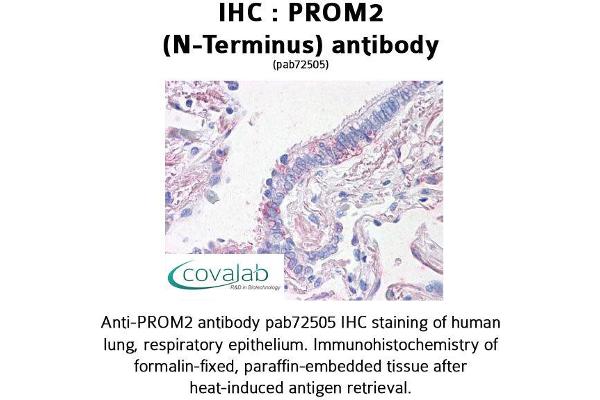 Prominin 2 Antikörper  (N-Term)
