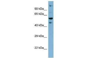 Host: Rabbit Target Name: ZNF573 Sample Type: HT1080 Whole Cell lysates Antibody Dilution: 1. (ZNF573 Antikörper  (Middle Region))