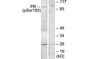 Western Blotting (WB) image for anti-Progesterone Receptor (PGR) (pSer190) antibody (ABIN2888516) (Progesterone Receptor Antikörper  (pSer190))
