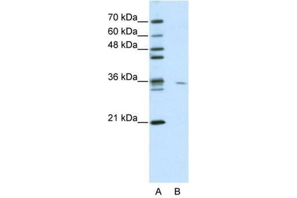 Use1 Antikörper  (N-Term)