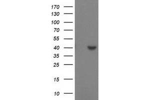 HEK293T cells were transfected with the pCMV6-ENTRY control (Left lane) or pCMV6-ENTRY SULT1C2 (Right lane) cDNA for 48 hrs and lysed. (SULT1C2 Antikörper)