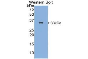 Detection of Recombinant AE1, Human using Polyclonal Antibody to Band 3 (BND3) (Band 3/AE1 Antikörper  (AA 35-290))