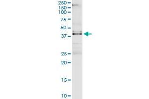 Immunoprecipitation of VRK1 transfected lysate using rabbit polyclonal anti-VRK1 and Protein A Magnetic Bead (VRK1 (Human) IP-WB Antibody Pair)