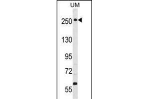 PRKWNK3 Antibody (ABIN391067 and ABIN2841218) western blot analysis in uterus tumor cell line lysates (35 μg/lane). (WNK3 Antikörper  (C-Term))