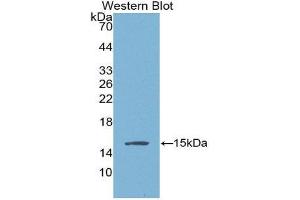 Western Blotting (WB) image for anti-Angiogenic Factor with G Patch and FHA Domains 1 (AGGF1) (AA 406-501) antibody (ABIN1866581) (AGGF1 Antikörper  (AA 406-501))