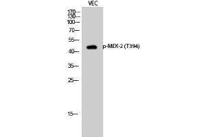 Western Blotting (WB) image for anti-Mitogen-Activated Protein Kinase Kinase 2 (MAP2K2) (pThr394) antibody (ABIN3179468) (MEK2 Antikörper  (pThr394))