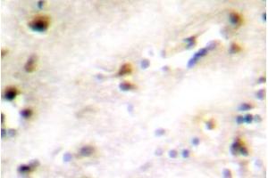 Image no. 2 for anti-ZFP36 Ring Finger Protein-Like 1 (ZFP36L1) antibody (ABIN317801) (ZFP36L1 Antikörper)