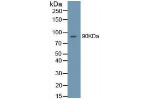 Western Blotting (WB) image for Matrix Metallopeptidase 9 (Gelatinase B, 92kDa Gelatinase, 92kDa Type IV Collagenase) (MMP9) ELISA Kit (ABIN6574164)