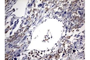 Immunohistochemistry (IHC) image for anti-ATP-Binding Cassette, Sub-Family D (Ald), Member 1 (ABCD1) (AA 508-745) antibody (ABIN2715621) (ABCD1 Antikörper  (AA 508-745))