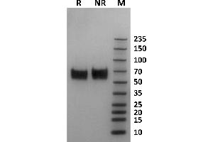 FCGR1A Protein (AA 16-281) (His-Avi Tag,Biotin)