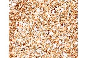 IHC testing of human tonsil (10X) stained with CD79a antibody cocktail (JCB117 + HM47/A9). (CD79a Antikörper  (AA 202-216))