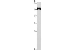 Western Blotting (WB) image for anti-Ellis Van Creveld Syndrome 2 (EVC2) antibody (ABIN2433002) (EVC2 Antikörper)